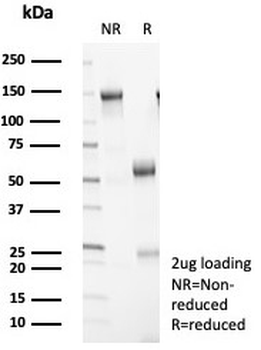 Recombinant 14-3-3E Antibody / YWHAE