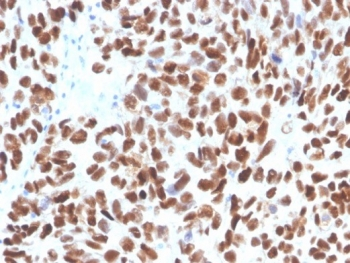 p53 Antibody / TP53
