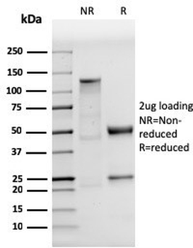 p53 Antibody / TP53