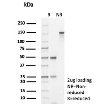 Recombinant TP53 Antibody / p53