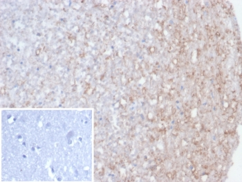 Recombinant CALB2 Antibody / Calretinin
