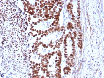 TP53 Antibody / p53