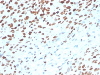 TP53 Antibody / p53