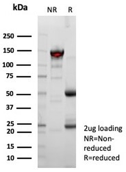 Recombinant MSLN Antibody / Mesothelin