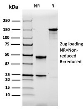 Recombinant TPSAB1 Antibody / Tryptase