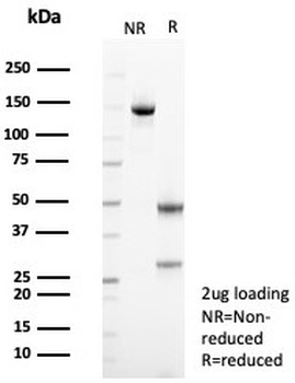 Recombinant Mesothelin Antibody