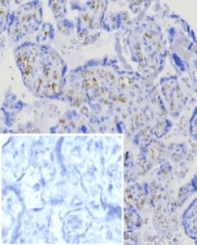 BCMA Antibody / CD269 / TNFRSF17