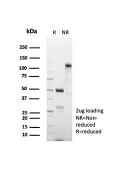 CD269 Antibody / BCMA / TNFRSF17