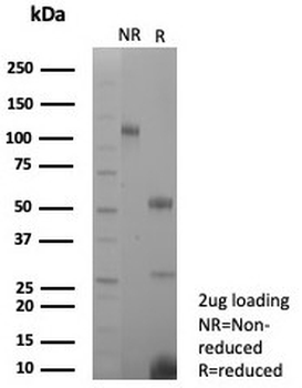 Estrogen Inducible Protein pS2 / TFF1 Antibody