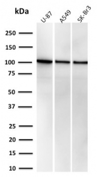 Major Vault Protein Antibody / MVP