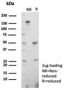 Estrogen Inducible Protein pS2 / TFF1 Antibody