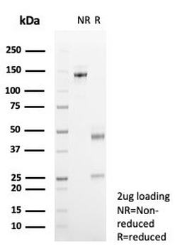 Estrogen Inducible Protein pS2 / TFF1 Antibody