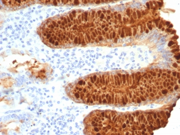 Estrogen Inducible Protein pS2 / TFF1 Antibody