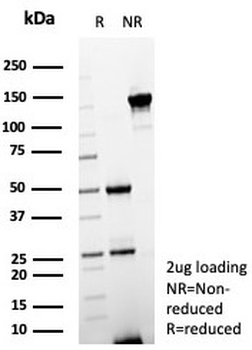 Estrogen Inducible Protein pS2 / TFF1 Antibody