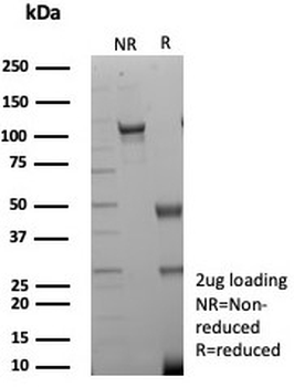 Creatine kinase B Antibody / CKBB / CKB