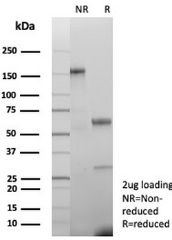 Creatine phosphokinase BB Antibody / CKBB / CKB