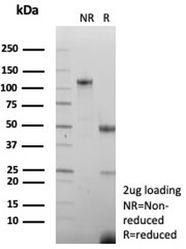 Creatine kinase B Antibody / Brain Creatine Kinase / CKBB