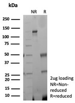 Recombinant CKBB Antibody / Creatine kinase B