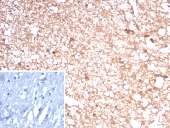Recombinant Creatine kinase B Antibody / CKB / Brain Creatine Kinase