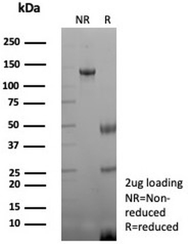 Recombinant Creatine kinase B Antibody / CKB / Brain Creatine Kinase