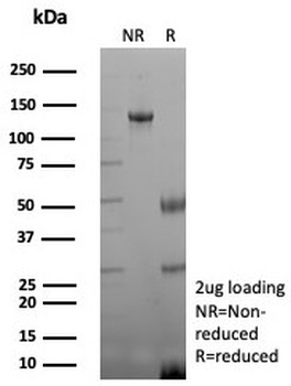 Recombinant CKBB Antibody / Creatine kinase B