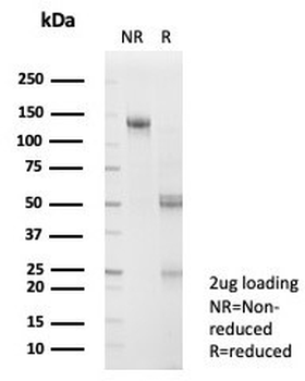 SKIP Antibody / SNW1 / NCoA-62