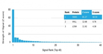 SNW1 Antibody / NCoA-62 / SKIP