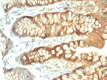 Recombinant LGALS3 Antibody / Galectin-3
