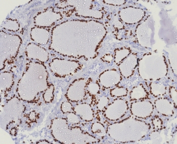 NKX2.1 Antibody / TTF-1