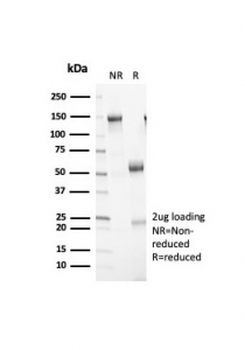 Recombinant Retinoblastoma Antibody