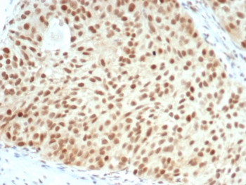 Recombinant Retinoblastoma Antibody
