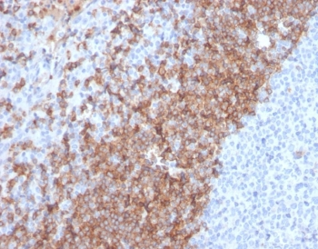 IgD Antibody / Heavy chain