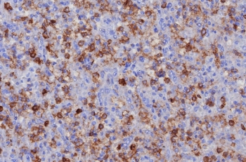PSGL-1 Antibody / CD162