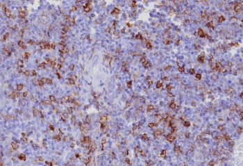 PSGL-1 Antibody / CD162
