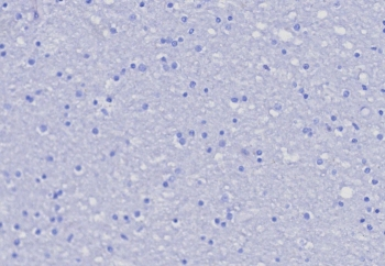 PSGL-1 Antibody / CD162