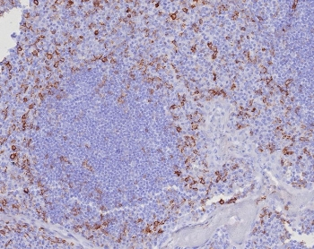 CD162 Antibody / PSGL-1