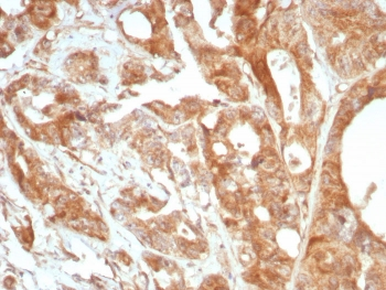 Periostin Antibody
