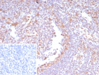CDK4 Antibody