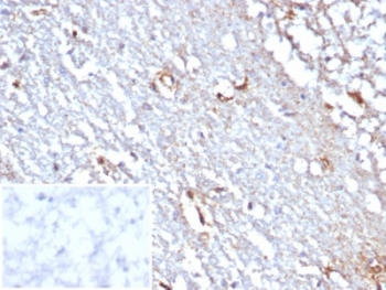 STAT6 Antibody