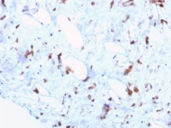 STAT6 Antibody