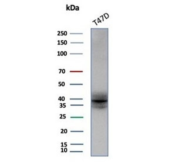 FGF23 Antibody / Fibroblast Growth Factor 23