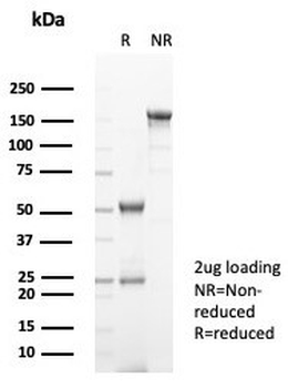 FGF23 Antibody / Fibroblast Growth Factor 23