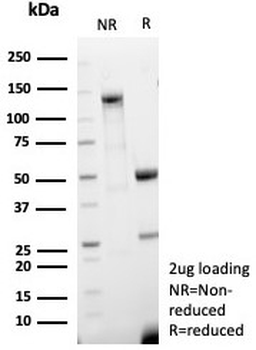 Recombinant LAMP-3 Antibody / CD63