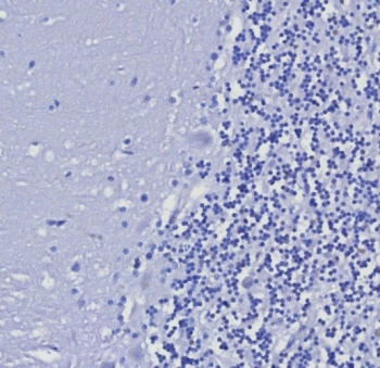 Cytokeratin 5/6 Antibody