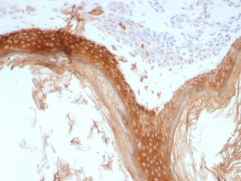 Recombinant Basic Cytokeratin Antibody