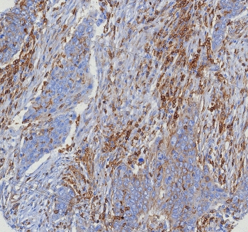 CD4 Antibody