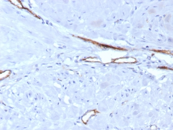 von Willebrand Factor Antibody