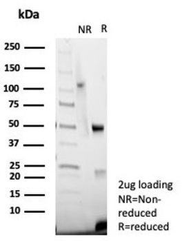 von Willebrand Factor Antibody