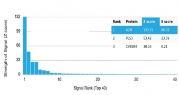 Alpha-2-Macroglobulin Antibody / A2M