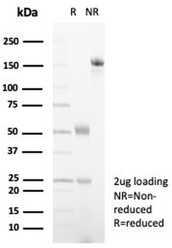 Alpha-2-Macroglobulin Antibody / A2M